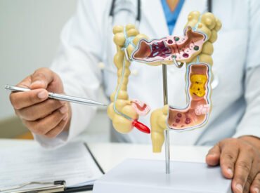 Ano-Rectal Clinical Service Ano-Rectal Clinical Service